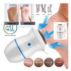 Find Back Callus Remover Machine (Cell Operate)